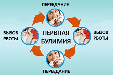 Лечение булимии в Ковдоре